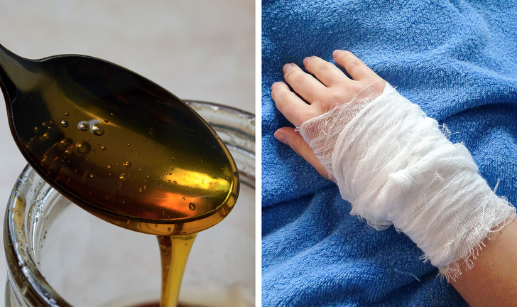 10 Home Remedies to Treat Fresh Wounds All Over Your Body