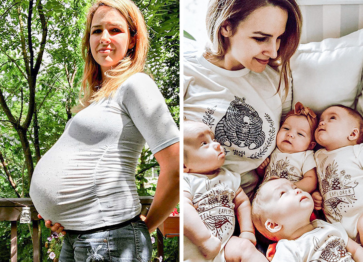 15 Before and After Pregnancy Shots That Show the Miracle of Birth