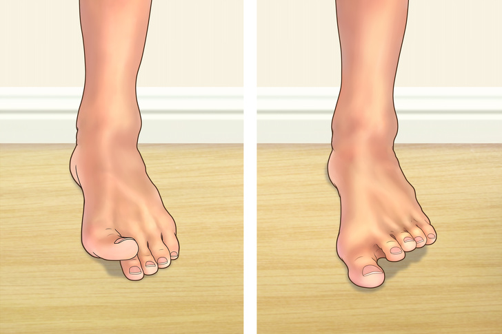 7 Exercises From Orthopedists to Increase Arch Height and Reduce Foot Pain
