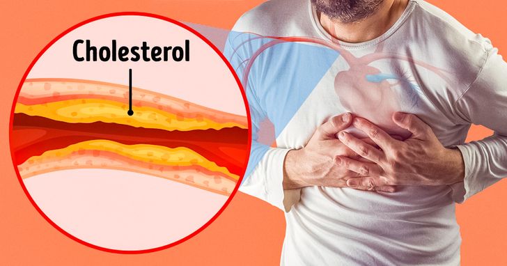 6 Dangerous Signs of Blocked Arteries We Often Ignore
