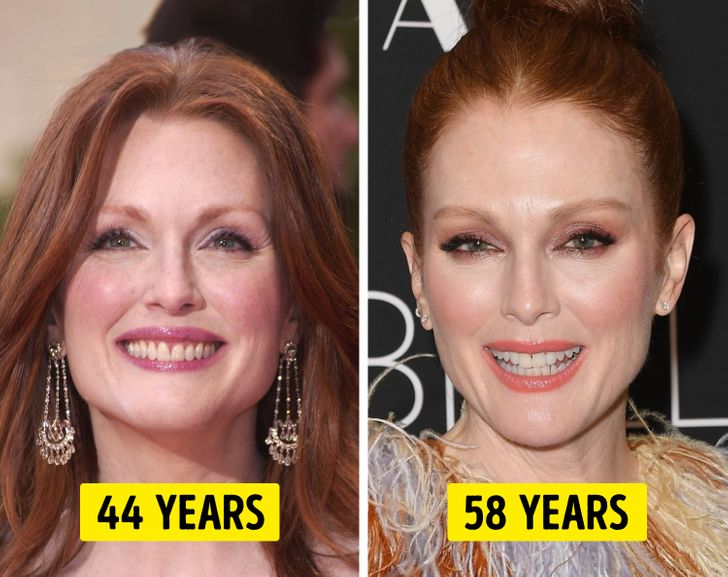 How Our Bodies Change After 30, and Why Our Faces Can Age So Drastically