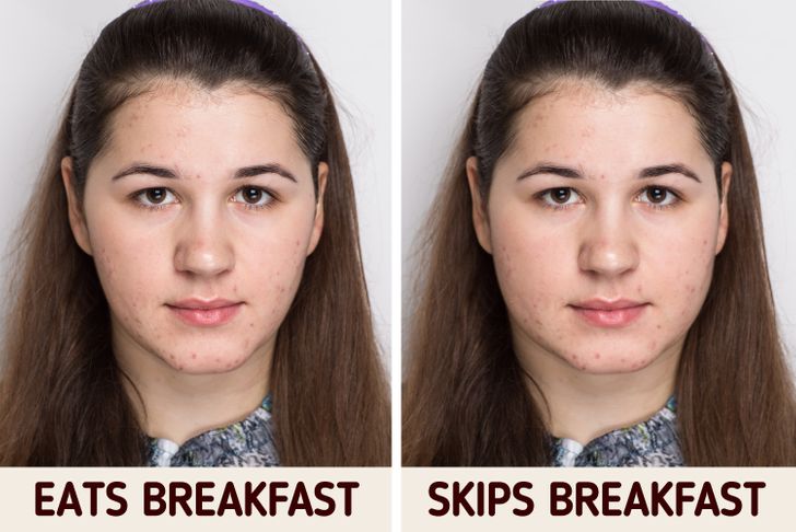 What Happens to Your Body If You Skip Breakfast Every Day