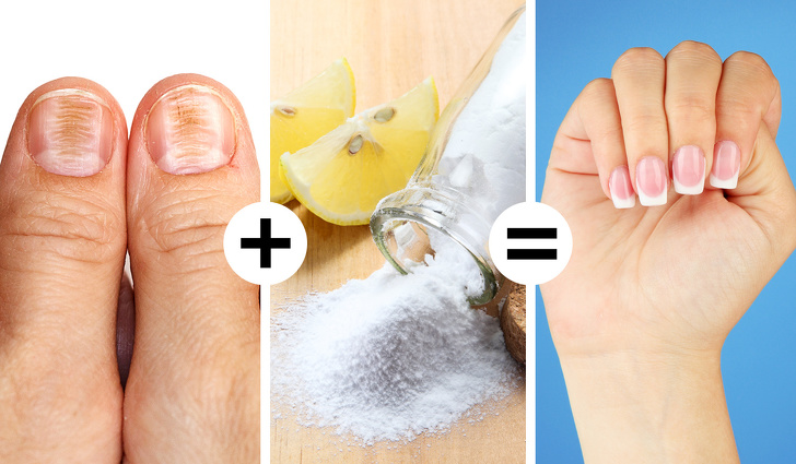 Baking soda and lemon to remove nail stains.