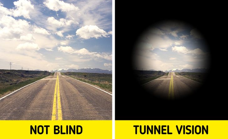 How People With Different Degrees and Causes of Impaired Vision Actually See the World