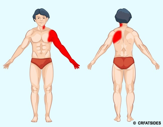 How to Understand What Really Causes You Pain