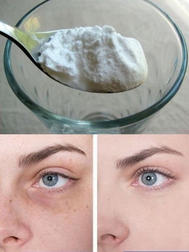 Use baking soda to reduce dark circles and bags under the eyes
