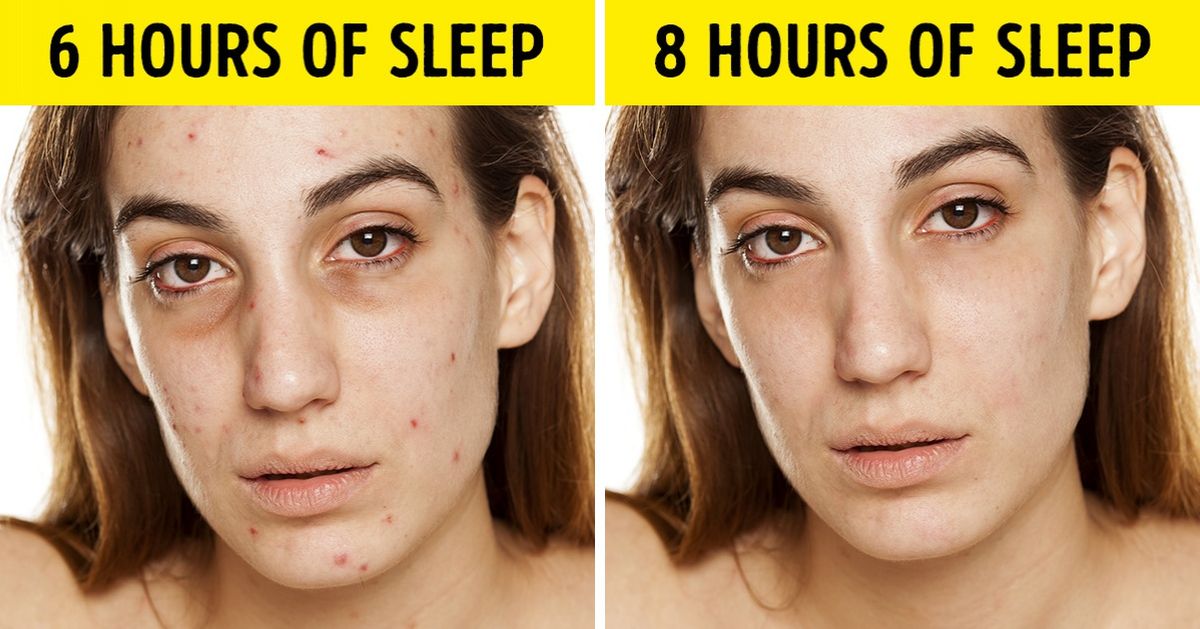 7 Thing Happens To Your Body When You Don T Get Enough Sleep