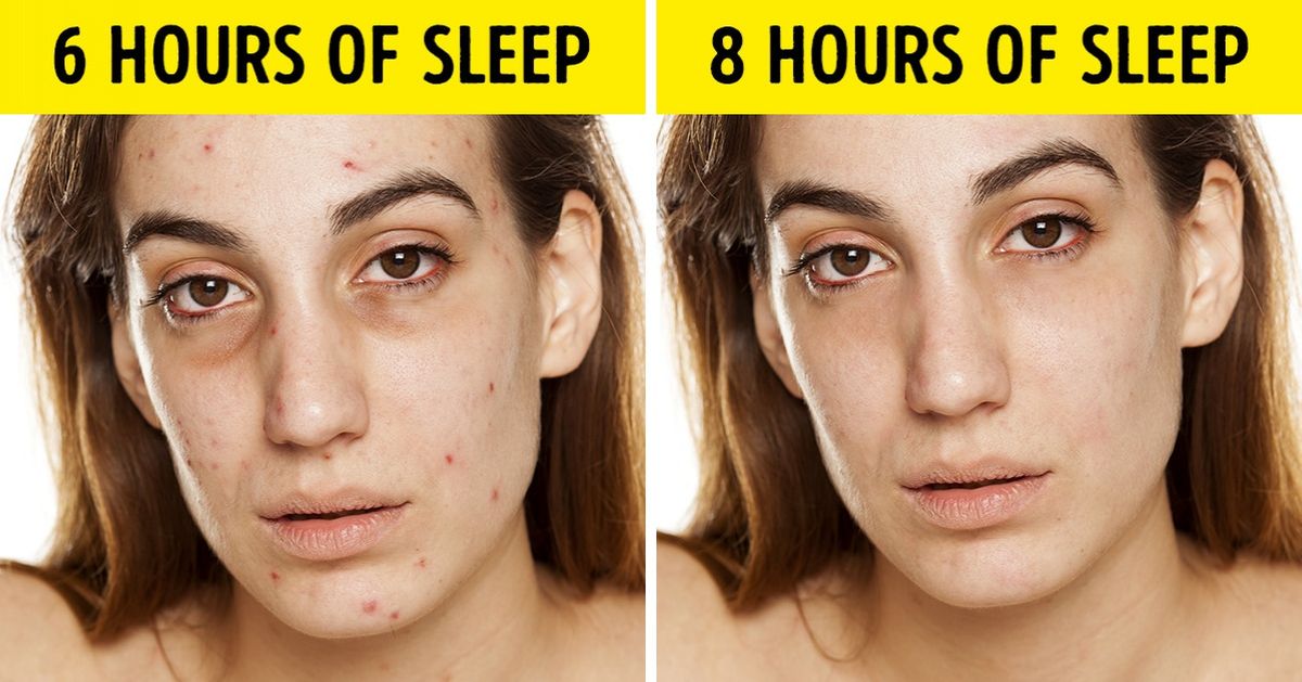 what happens if you don't sleep for 7 days