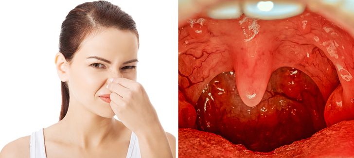 9 Surprising Daily Do’s and Don’ts to Avoid Bad Breath
